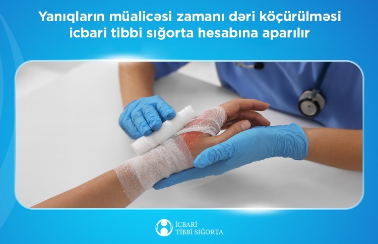 Yanıqların müalicəsi zamanı dəri köçürülməsi icbari tibbi sığorta hesabına aparılır 